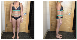 Weight Loss Brookfield WI Client A After