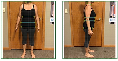 Weight Loss Brookfield WI Client B After