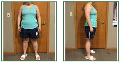 Weight Loss Brookfield WI Client C After