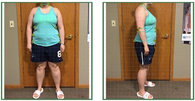 Weight Loss Brookfield WI Client C Before