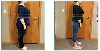 Weight Loss Brookfield WI Lean Side